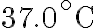 37.0^{\circ} \mathrm{C}